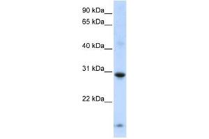 Western Blot showing ZNF138 antibody used at a concentration of 1-2 ug/ml to detect its target protein. (ZNF138 抗体  (Middle Region))