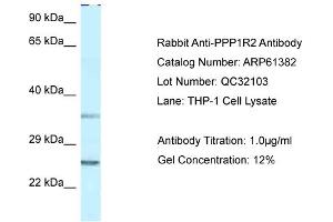 Western Blotting (WB) image for anti-Protein Phosphatase 1, Regulatory (Inhibitor) Subunit 2 (PPP1R2) (N-Term) antibody (ABIN2788785) (PPP1R2 抗体  (N-Term))