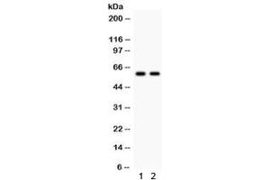 Western blot testing of 1) rat kidney and 2) human MCF7 lysate with CYP1B1 antibody.