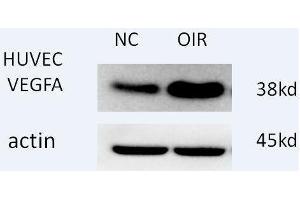 Western blot analysis of extracts of H460 cells, using antibody at 1:1000 dilution. (VEGFA 抗体  (AA 1-147))