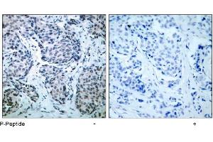 Image no. 1 for anti-Mitogen-Activated Protein Kinase Kinase 4 (MAP2K4) (pThr261) antibody (ABIN196908) (MAP2K4 抗体  (pThr261))