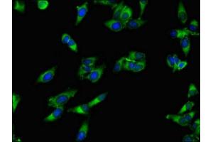 Immunofluorescent analysis of Hela cells using ABIN7143250 at dilution of 1:100 and Alexa Fluor 488-congugated AffiniPure Goat Anti-Rabbit IgG(H+L)