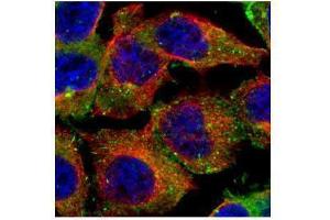 ICC/IF Image Confocal immunofluorescence analysis (Olympus FV10i) of paraformaldehyde-fixed A431, using CD2AP, antibody (Green) at 1:500 dilution. (CD2AP 抗体)