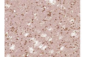 Paraformaldehyde-fixed, paraffin embedded Human brain glioma Antigen retrieval by boiling in sodium citrate buffer (pH6. (STAT1 抗体)