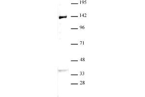 JMJD2B / KDM4B antibody (pAb) tested by Western blot. (KDM4B 抗体  (C-Term))