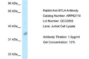 Western Blotting (WB) image for anti-B and T Lymphocyte Associated (BTLA) (Middle Region) antibody (ABIN2789022) (BTLA 抗体  (Middle Region))