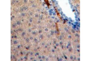 IHC-P analysis of Liver tissue, with DAB staining. (IL-31 抗体  (AA 28-154))