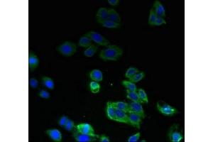 Immunofluorescent analysis of HepG2 cells using ABIN7168896 at dilution of 1:100 and Alexa Fluor 488-congugated AffiniPure Goat Anti-Rabbit IgG(H+L) (SPTLC2 抗体  (AA 88-562))
