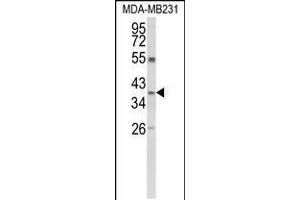 Western blot analysis of ARG1 Antibody in MDA-MB231 cell line lysates (35ug/lane) (Liver Arginase 抗体  (C-Term))