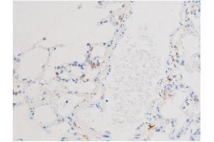ABIN6267576 at 1/200 staining Rat lung tissue sections by IHC-P. (Smad2/3 抗体  (pThr8, Thr8))