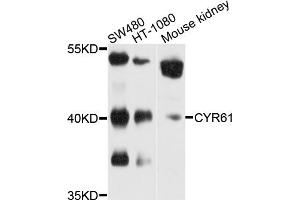 Western blot analysis of extracts of various cell lines, using CYR61 antibody (ABIN5970462) at 1/1000 dilution. (CYR61 抗体)