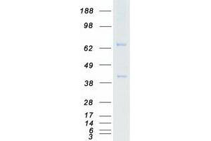 Western Blotting (WB) image for PX domain-containing protein kinase-like protein (PXK) protein (Myc-DYKDDDDK Tag) (ABIN2730196)
