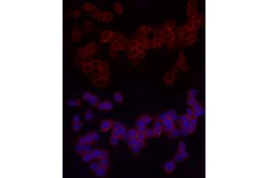Immunofluorescence analysis of THP-1 cells using CD18 Rabbit pAb (ABIN3023117, ABIN3023118, ABIN3023119 and ABIN6219398) at dilution of 1:50 (40x lens). (Integrin beta 2 抗体  (AA 70-170))