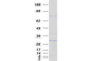 Validation with Western Blot