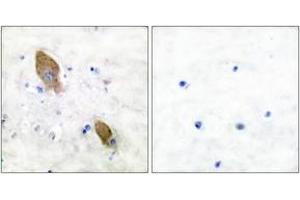 Immunohistochemistry (IHC) image for anti-PTK2B Protein tyrosine Kinase 2 beta (PTK2B) (AA 847-896), (pTyr881) antibody (ABIN1531239)