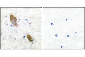 Immunohistochemistry analysis of paraffin-embedded human brain, using PYK2 (Phospho-Tyr881) Antibody. (PTK2B 抗体  (pTyr881))