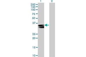 Western Blot analysis of HLA-DRA expression in transfected 293T cell line by HLA-DRA MaxPab polyclonal antibody. (HLA-DRA 抗体  (AA 1-254))