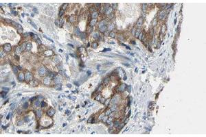 ABIN6276478 at 1/100 staining Human prostate tissue by IHC-P. (ACTR3 抗体  (C-Term))