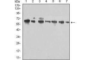 Western Blotting (WB) image for anti-CD96 (CD96) (AA 321-519) antibody (ABIN7193223)