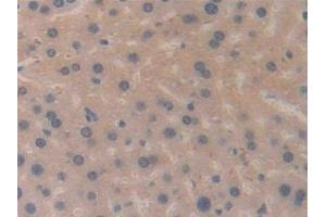 Immunohistochemistry (IHC) image for anti-Meningioma Expressed Antigen 5 (Hyaluronidase) (MGEA5) (AA 83-222) antibody (ABIN7430756)
