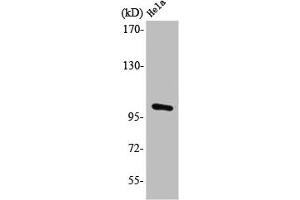 Western Blot analysis of HeLa cells using PMS2 Polyclonal Antibody (PMS2 抗体  (Internal Region))