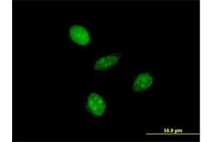 Immunofluorescence (IF) image for anti-General Transcription Factor IIA, 1-Like (GTF2A1L) (AA 251-348) antibody (ABIN564784)