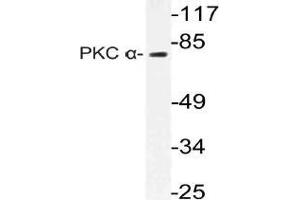 Western blot (WB) analysis of PKC alpha antibody in extracts from Jurkat cells. (PKC alpha 抗体)