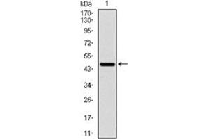 Western Blotting (WB) image for anti-Ribosomal Protein S6 Kinase, 70kDa, Polypeptide 1 (RPS6KB1) antibody (ABIN1108904) (RPS6KB1 抗体)