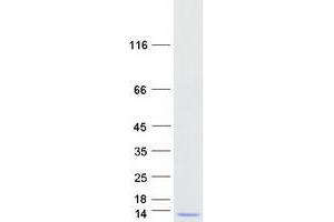Western Blotting (WB) image for General Transcription Factor IIH, Polypeptide 5 (GTF2H5) protein (Myc-DYKDDDDK Tag) (ABIN2722321)