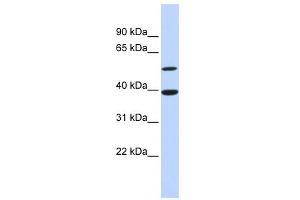 WB Suggested Anti-ATF7 Antibody Titration:  0. (AFT7 抗体  (N-Term))