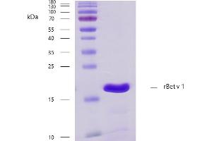 Recombinant allergen rBet v 1 purity verification. (PFN1 蛋白)