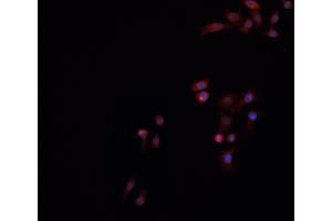 ABIN6269016 staining HeLa cells by IF/ICC. (Ku70/80 抗体)
