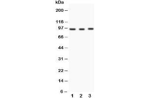 Western blot testing of FER antibody and Lane 1:  HeLa;  2: rat testis;  3: rat ovary (FER 抗体  (Middle Region))