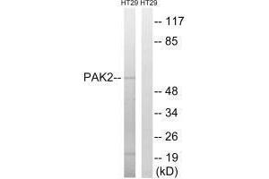 Western blot analysis of extracts from HT-29 cells, using PAK2 (Ab-197) antibody.