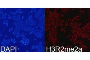 Immunofluorescence analysis of 293T cell using H3R2me2a antibody. (Histone 3 抗体  (H3R2me2a))