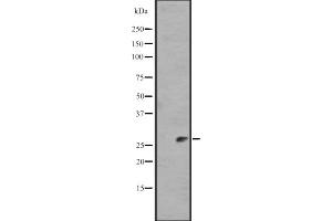 Western blot analysis of IL11 expression in Human Plasma Total Protein Lysate ,The lane on the left is treated with the antigen-specific peptide. (IL-11 抗体  (N-Term))