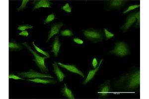Immunofluorescence of monoclonal antibody to PURA on HeLa cell.