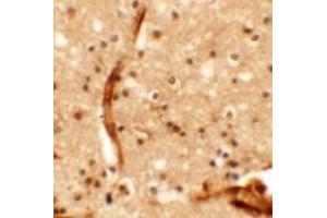 Immunohistochemistry of KCNK13 in human brain tissue with KCNK13 antibody at 5 ug/mL. (KCNK13 抗体  (Middle Region))