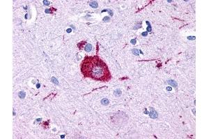 Immunohistochemical staining of Brain (Neuron) using anti- GPR116 antibody ABIN122116 (G Protein-Coupled Receptor 116 抗体  (Cytoplasmic Domain))