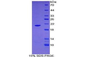 SDS-PAGE analysis of Human ARPC4 Protein. (ARPC4 蛋白)