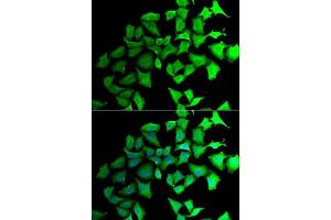 Immunofluorescence analysis of HeLa cells using TALDO1 antibody. (TALDO1 抗体  (AA 1-337))