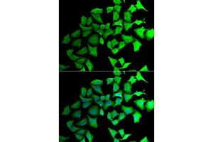 Immunofluorescence analysis of HeLa cells using TALDO1 antibody. (TALDO1 抗体  (AA 1-337))