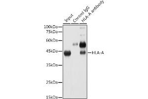 Immunoprecipitation analysis of 300 μg extracts of HeLa cells using 3 μg HLA-A antibody (ABIN7268366). (HLA-A 抗体)