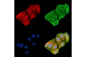ABIN6258570 and ABIN6274563 staining Hela cells by IF/ICC. (YWHAE 抗体  (C-Term))