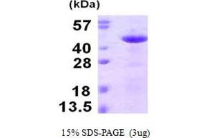 Image no. 1 for Reticulocalbin 3, EF-Hand Calcium Binding Domain (RCN3) (AA 21-328) protein (His tag) (ABIN667691)
