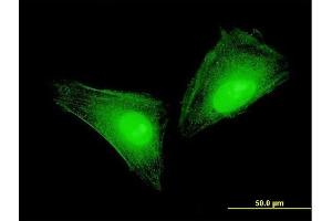 Immunofluorescence of monoclonal antibody to S100A11 on HeLa cell. (S100A11 抗体  (AA 1-105))