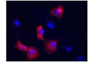 Vimentin antibody used at a dilution of 1:400 to detect COS7 cells.
