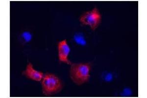 Vimentin antibody used at a dilution of 1:400 to detect COS7 cells. (Vimentin 抗体  (N-Term))