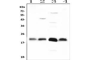 Western blot analysis of FGF21 using anti-FGF21 antibody (ABIN4886586). (FGF21 抗体  (AA 29-209))