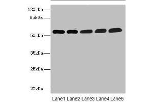 Western blot All lanes: MPP6 antibody at 3. (MPP6 抗体  (AA 220-420))